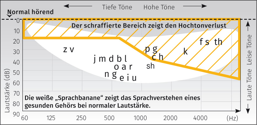 Grafik Sprachbanane zu Sprachverständlichkeit von Tönen und Frequenzen